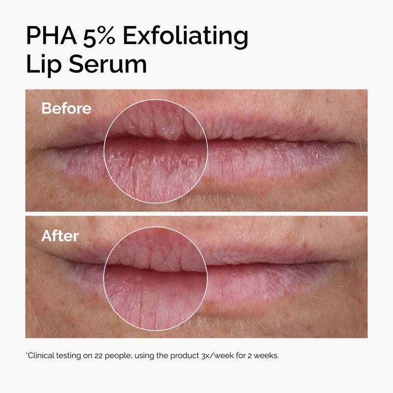 ord-pha-5pct-lip-exfoliating-serum-before-after
